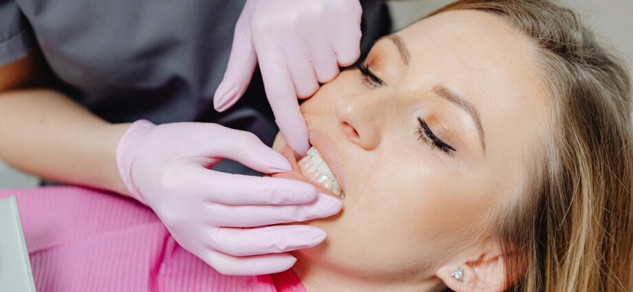 aparat dentar invizibil